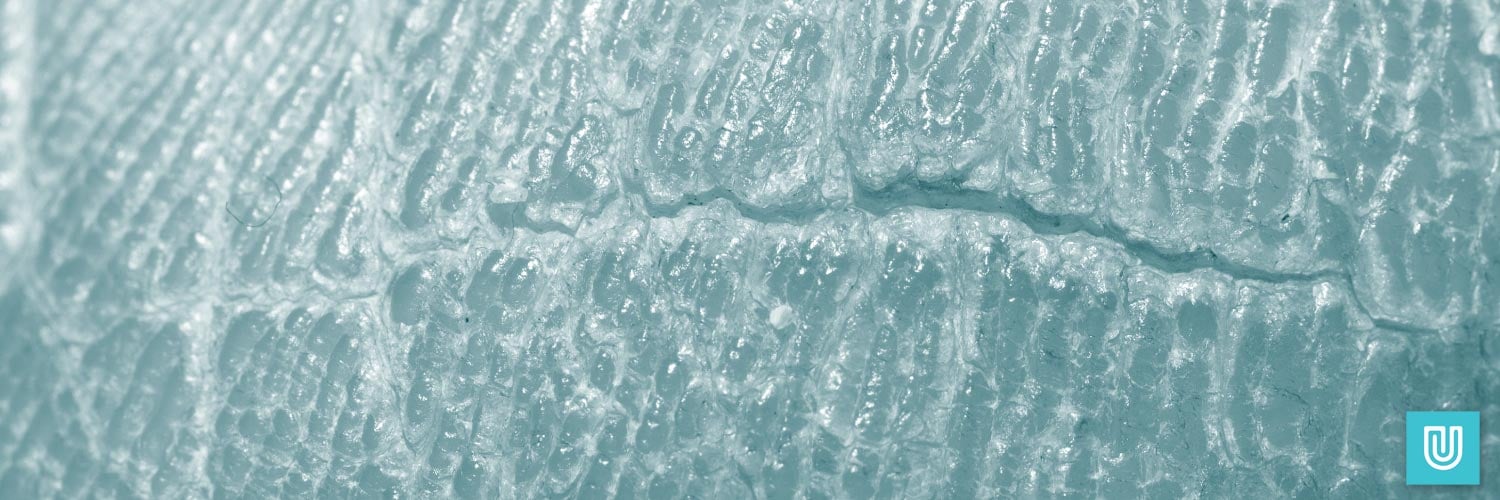 How Likely is an Allergic Reaction to Vinyl Gloves? Unigloves